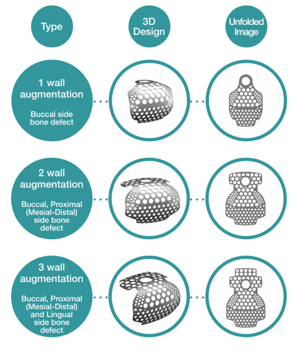 3d Titanium Mesh with Cap Hole- CHINA - Image 3